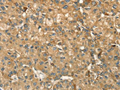 HSD17B8 Antibody