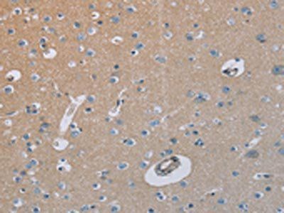 HSD3B7 Antibody