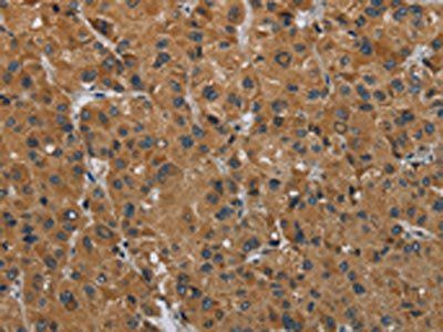 HSD3B7 Antibody