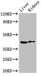 HSD3B7 antibody