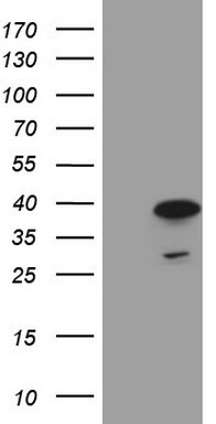 hSET1 (SETD1A) antibody