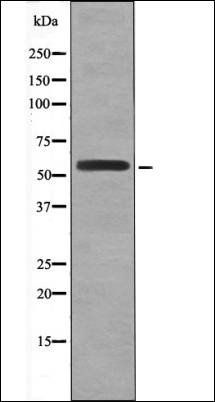HSF1 (Phospho-Ser307) antibody