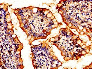HSF2 Antibody