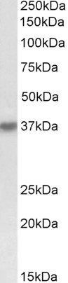 HSH2D antibody