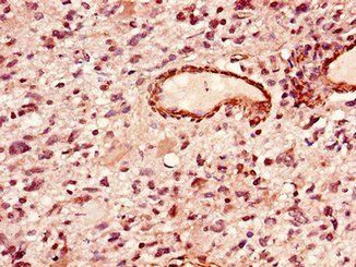 LIPE Antibody