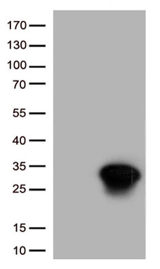HSP27 (HSPB1) antibody