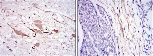 HSP27 Antibody