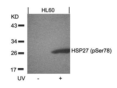 HSP27 (Phospho-Ser78) Antibody