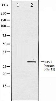 HSP27 (Phospho-Ser82) antibody