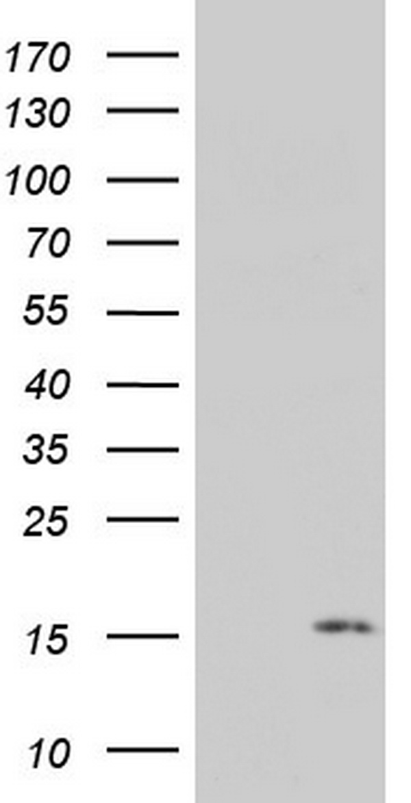 Hsp60 (HSPD1) antibody