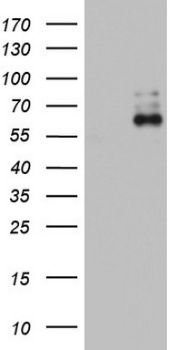 Hsp60 (HSPD1) antibody