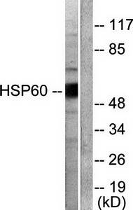 HSP60 antibody