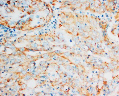 Anti-HSP60/HSPD1 Antibody