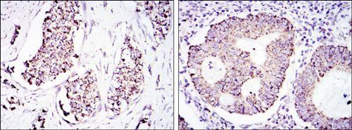 HSP60 Antibody