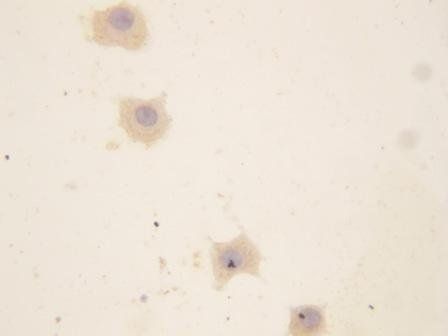 Anti-GRP94/HSP90B1 Antibody