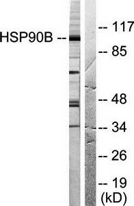 HSP90B (Ab-254) Antibody