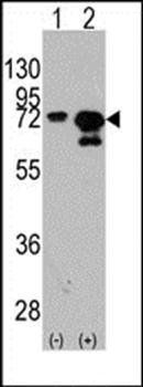 HSPA1A/HSPA1B antibody
