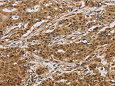 HSPA4 Antibody