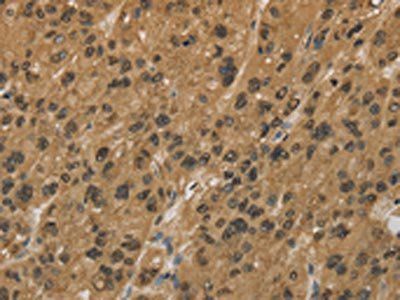 HSPA4 Antibody
