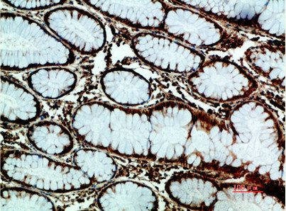 HSPA5 Antibody
