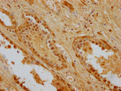 HSPA8 Monoclonal Antibody