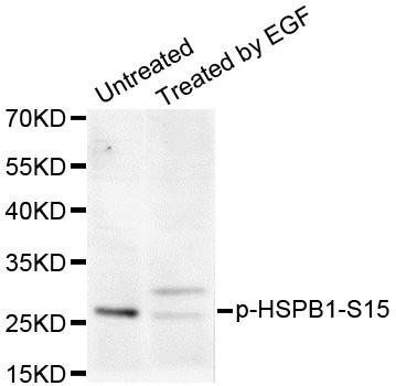 HSPB1 (phospho-S15) antibody