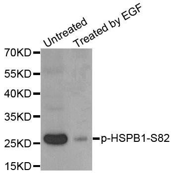 HSPB1 (phospho-S82) antibody
