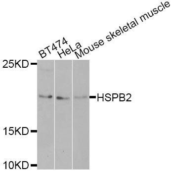 HSPB2 antibody