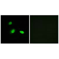 HSPB2 Antibody