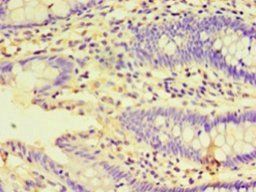HSPBAP1 Antibody