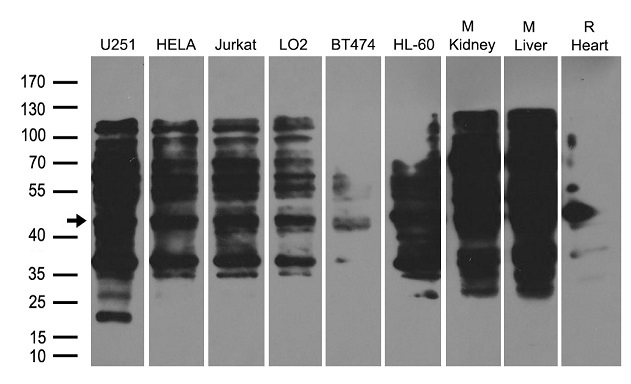 HSPC142 (BABAM1) antibody