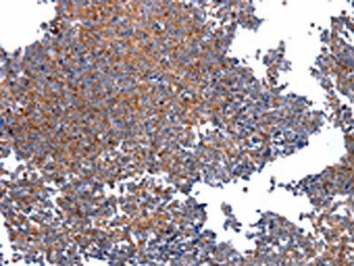 HSPD1 Antibody