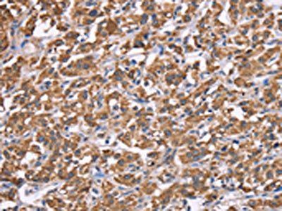 HSPE1 Antibody
