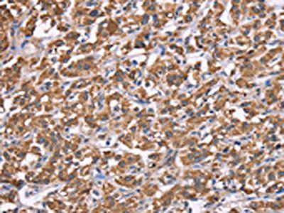 HSPE1 antibody