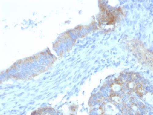 Heparan Sulfate Proteoglycan (Large) / Perlecan Antibody