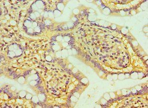 HTATIP2 Antibody