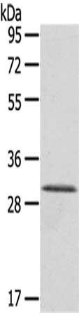 HTATIP2 antibody