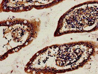 HTR1A Antibody