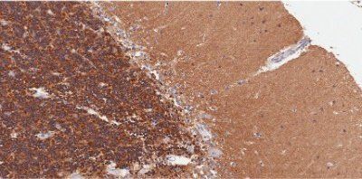 Goat anti-5HT2A Receptor (aa296-309) Antibody