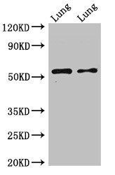 HTR3A antibody