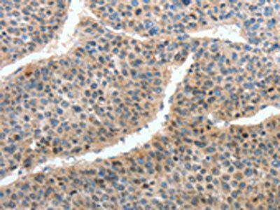 HTR3A Antibody
