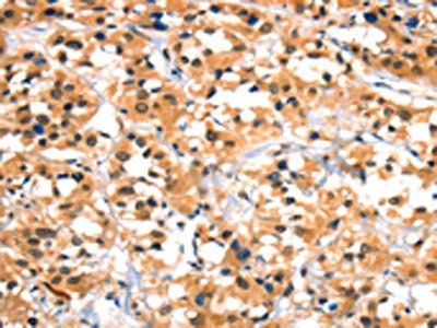 HTR3B Antibody