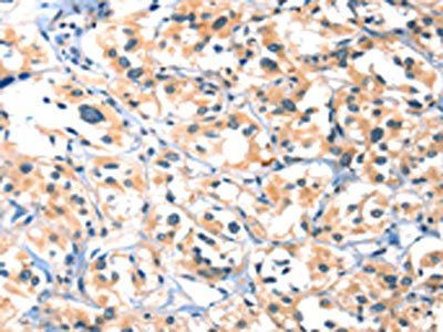 HTR3B Antibody