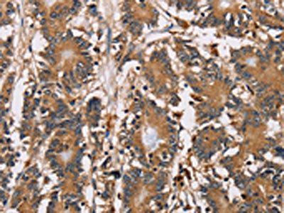 HTR3C Antibody