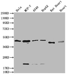 HTR3E Antibody