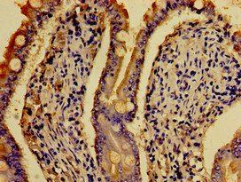 HTR4 Antibody