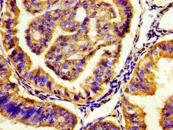 HTR7 Antibody