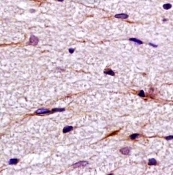 HuC Rabbit Polyclonal Antibody
