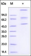 Human ADAM8 Protein, His Tag