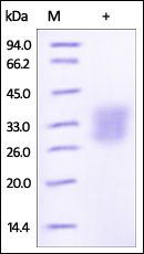 Human Angiopoietin-like 3 / ANGPTL3 Protein